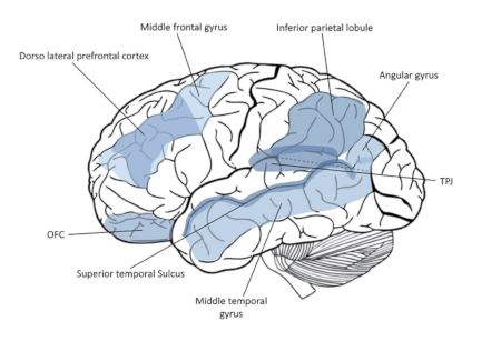 Cerebro