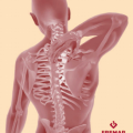 Prevención del dolor de espalda